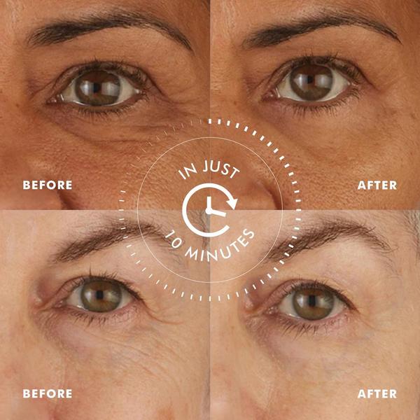 Skyn Iceland Hydro Cool Firming Eye Gels #6