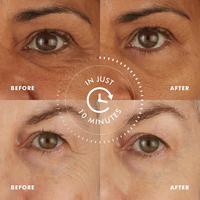 Skyn Iceland Hydro Cool Firming Eye Gels #5