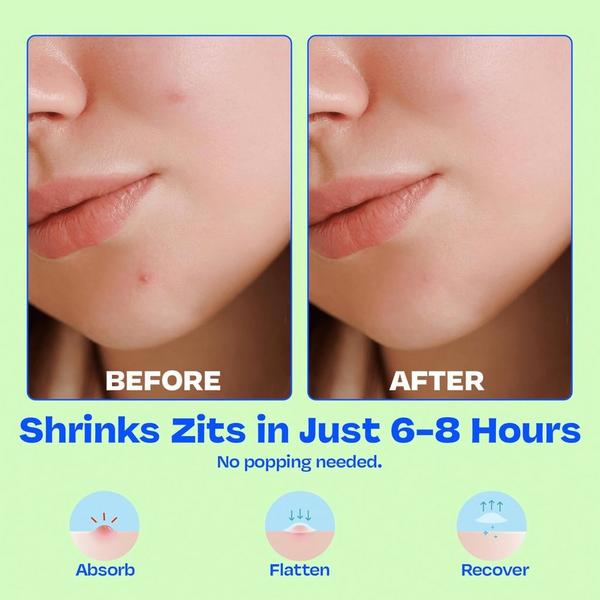 JB Skrub Clear Pimple Patches Set for Tweens and Teens #2