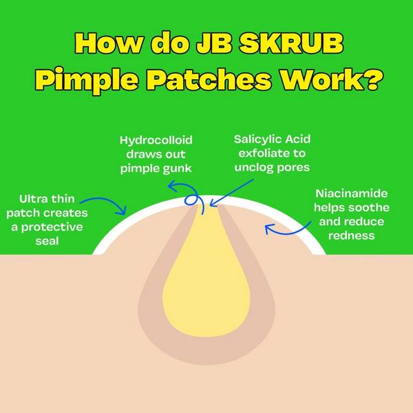 JB Skrub Clear Pimple Patches Set for Tweens and Teens #6