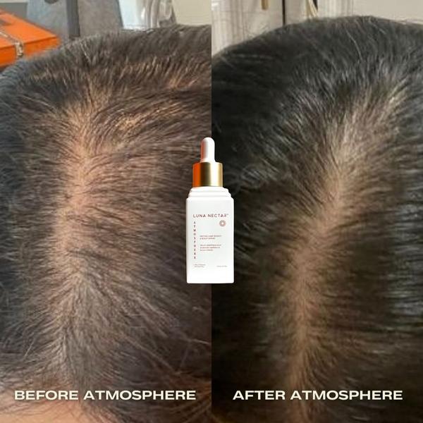 Luna Nectar Atmosphere Multi-Peptide Hair Density & Scalp Serum #2