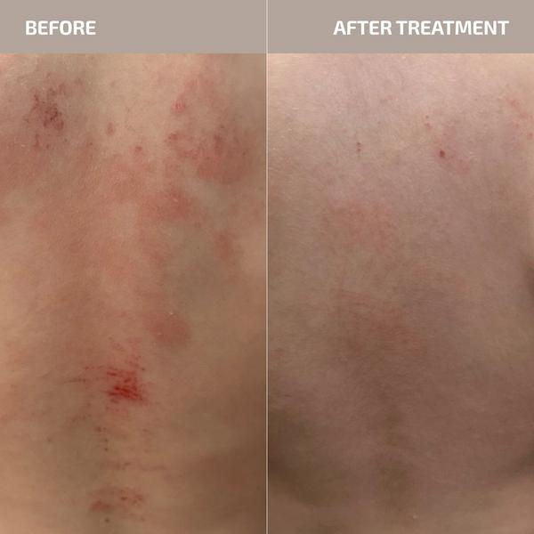 Codex Labs ANTÜ Skin Barrier Support Supplement #2