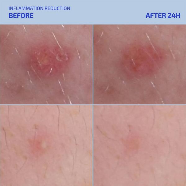 Codex Labs Shaant Spot Hero Blemish Treatment #3