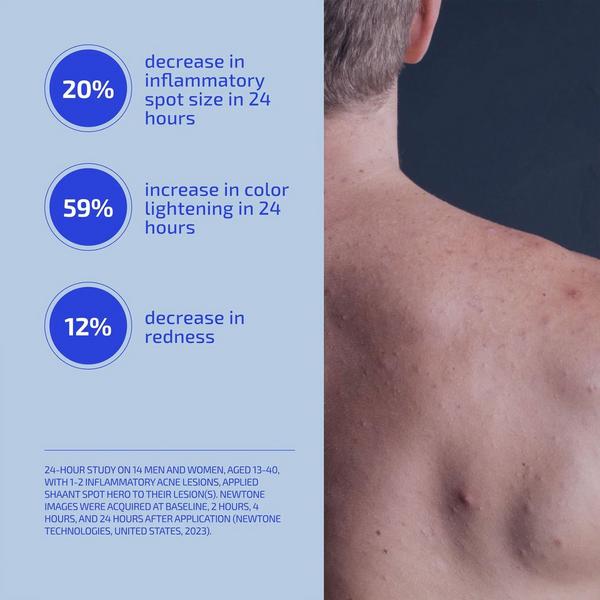 Codex Labs Shaant Spot Hero Blemish Treatment #5