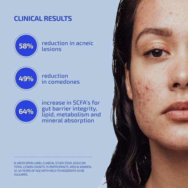 Codex Labs Shaant Clear Skin Probiotic Supplement 2.0 #5