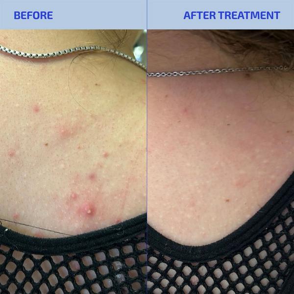 Codex Labs Shaant Hydrating Acne Body Scrub #2