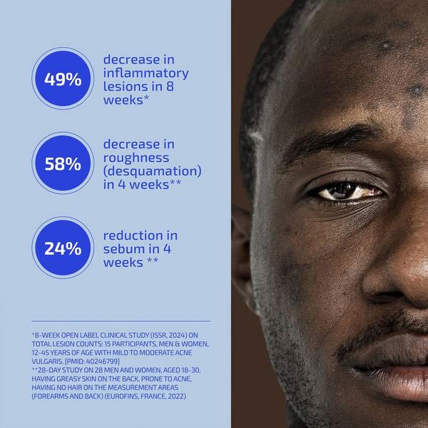 Codex Labs Shaant Hydrating Acne Body Scrub #3