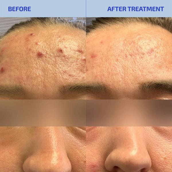 Codex Labs Shaant Pore Purifying Face Scrub #2