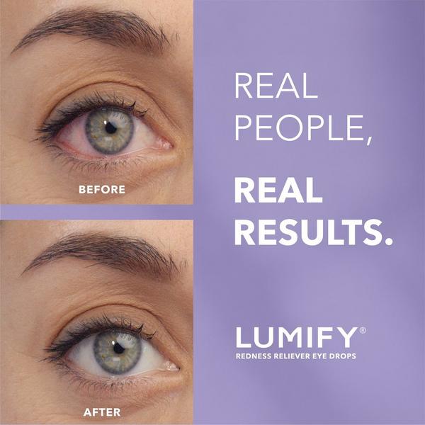 Lumify Redness Reliever Eye Drops #2