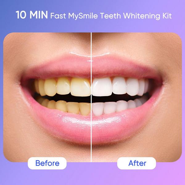 MySmile Ultimate Teeth Whitening Kit with Enamel Strengthening Gel + Extra Gel Refill Pack Bundle #2