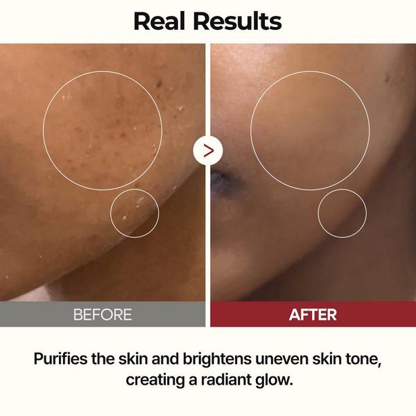 Dr. Melaxin Peel Shot Glow White Rice Toner #6