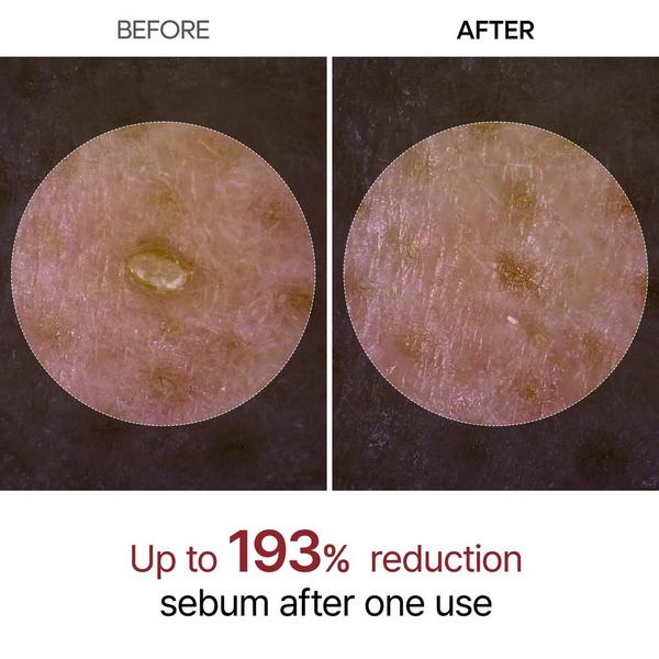 Dr. Melaxin Peel Shot Glow Black Rice Ampoule #3