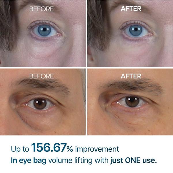 Dr. Melaxin Eyephalt Eyecream for Eyebags #2