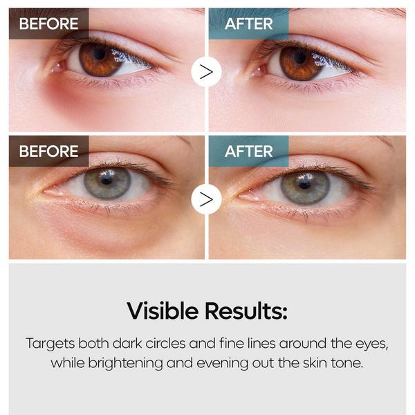 Dr. Melaxin TX Retinalsome Double Effect Eye Cream #5