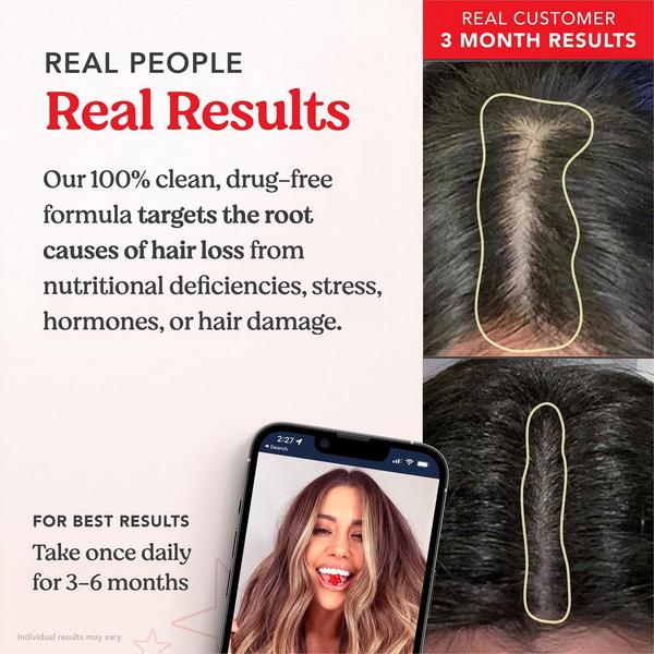 HAIRtamin Gummy Stars #4