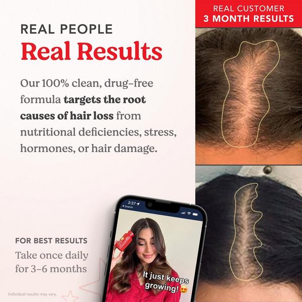 HAIRtamin Advanced Formula #4