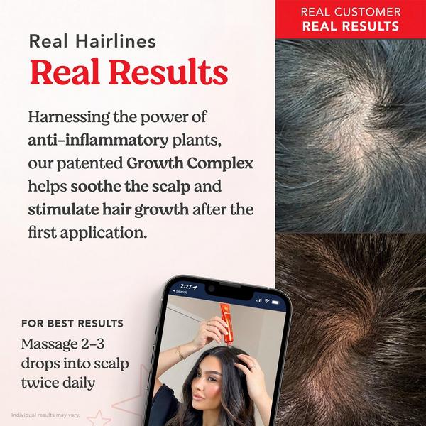 HAIRtamin Scalp Serum #4