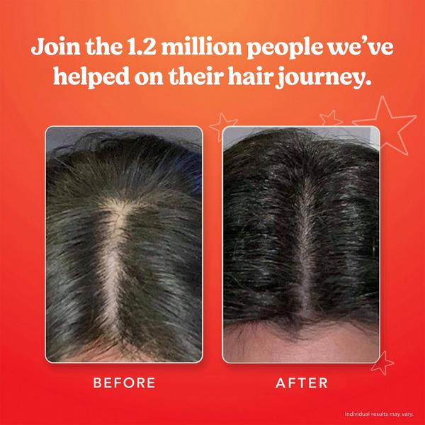 HAIRtamin Scalp Serum #6