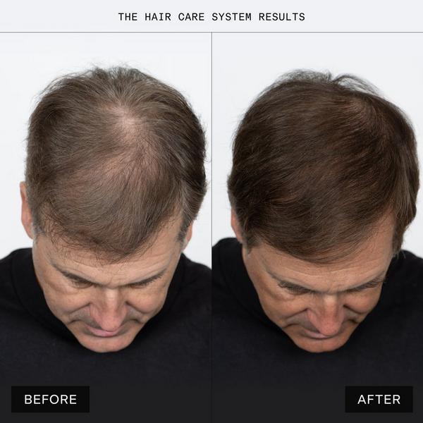 Caldera + Lab The Hair Serum #5