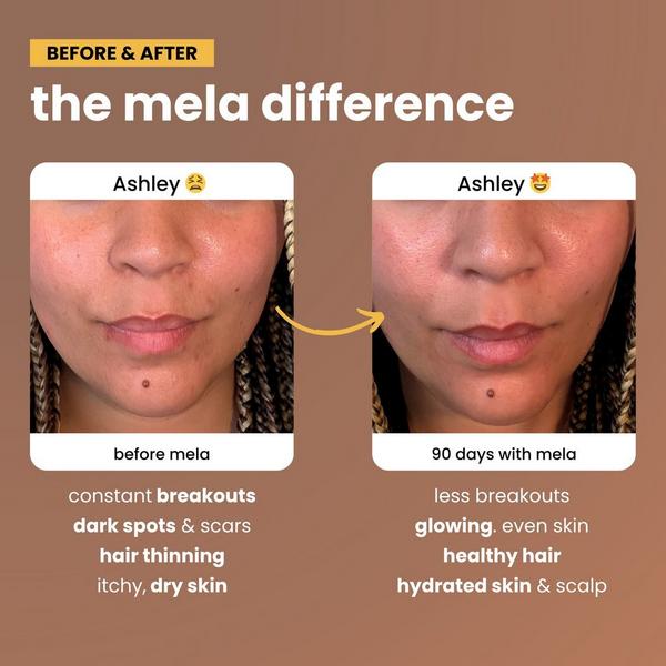 Mela Vitamins Daily Glow for Women of Color #4