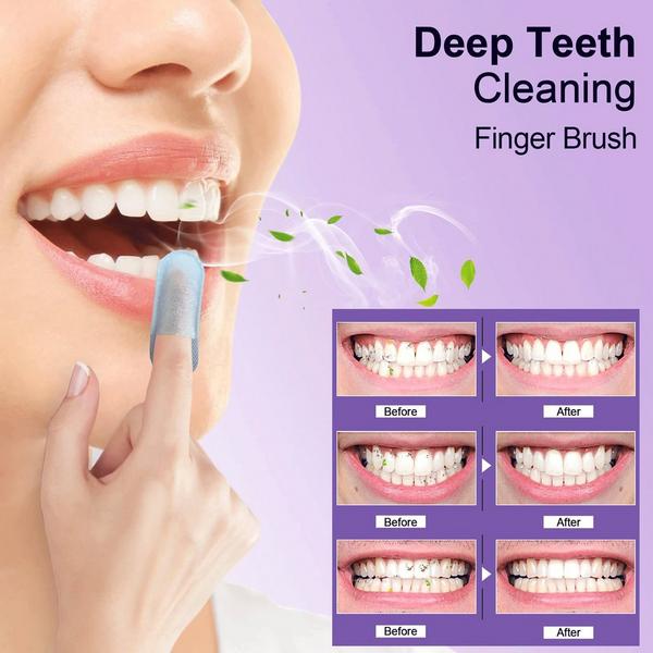 MySmile Advanced Teeth Whitening Kit With Teeth Wipes Double Pack #6