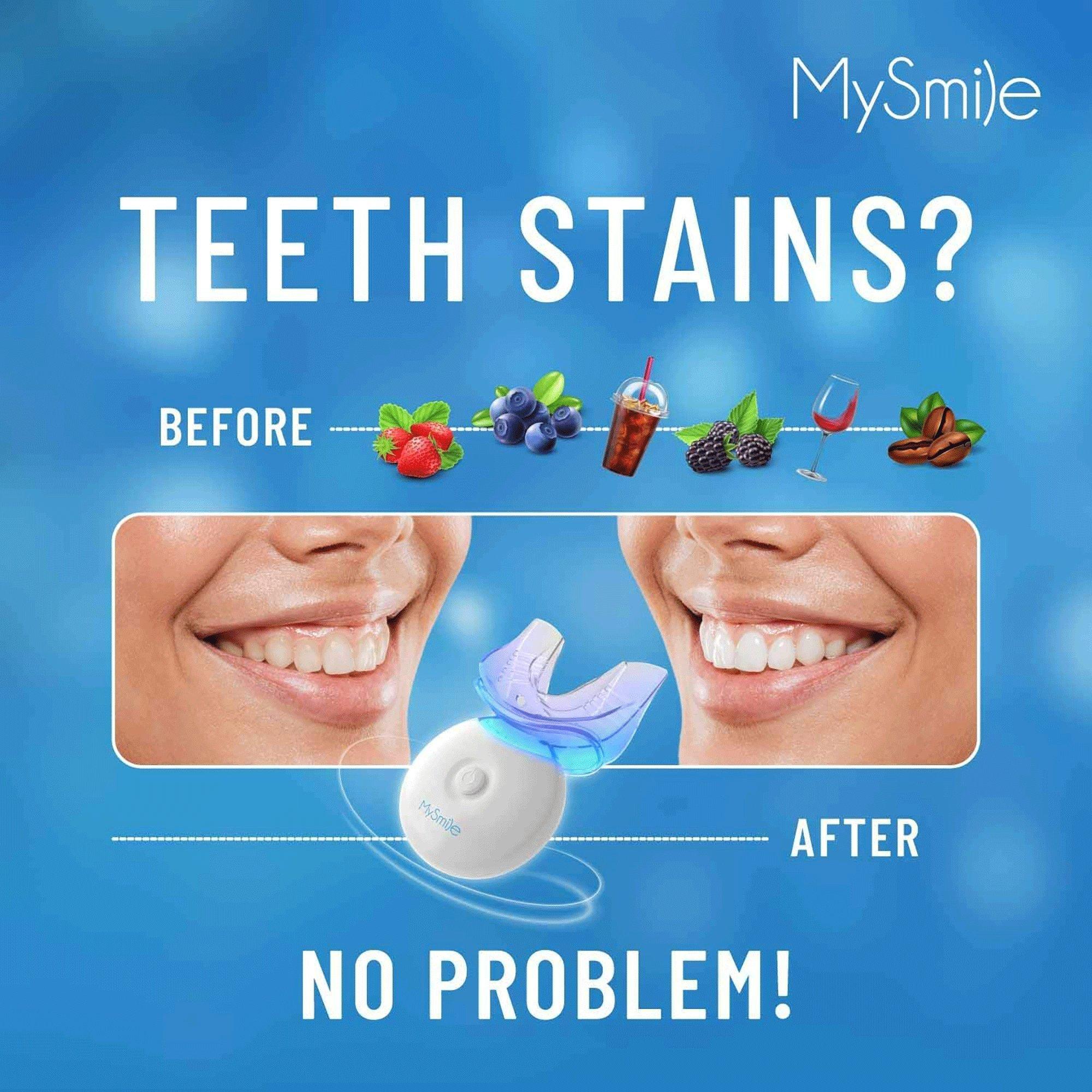 MySmile Teeth Whitening Kit - Thumbnail 3
