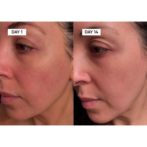 Plantkos Replenishing Essence #3