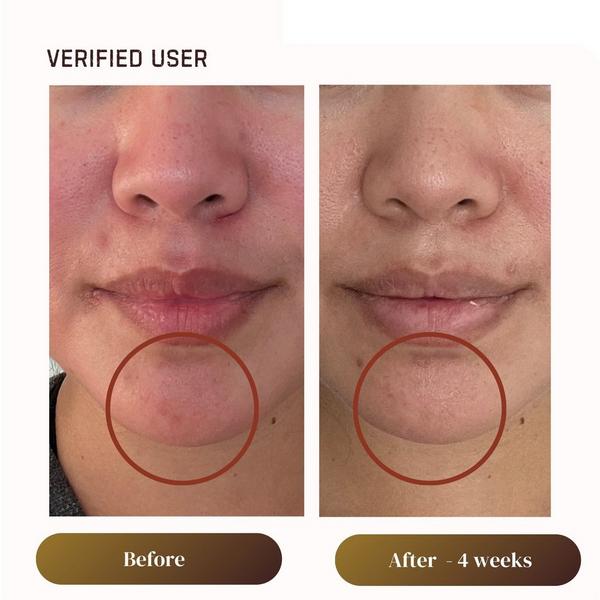 Plantkos Replenishing Essence #4