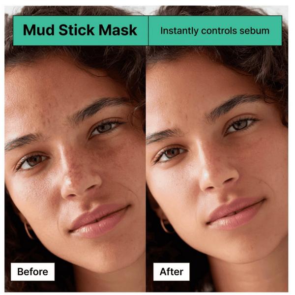BRMUD Relief Mud Stick Mask #3