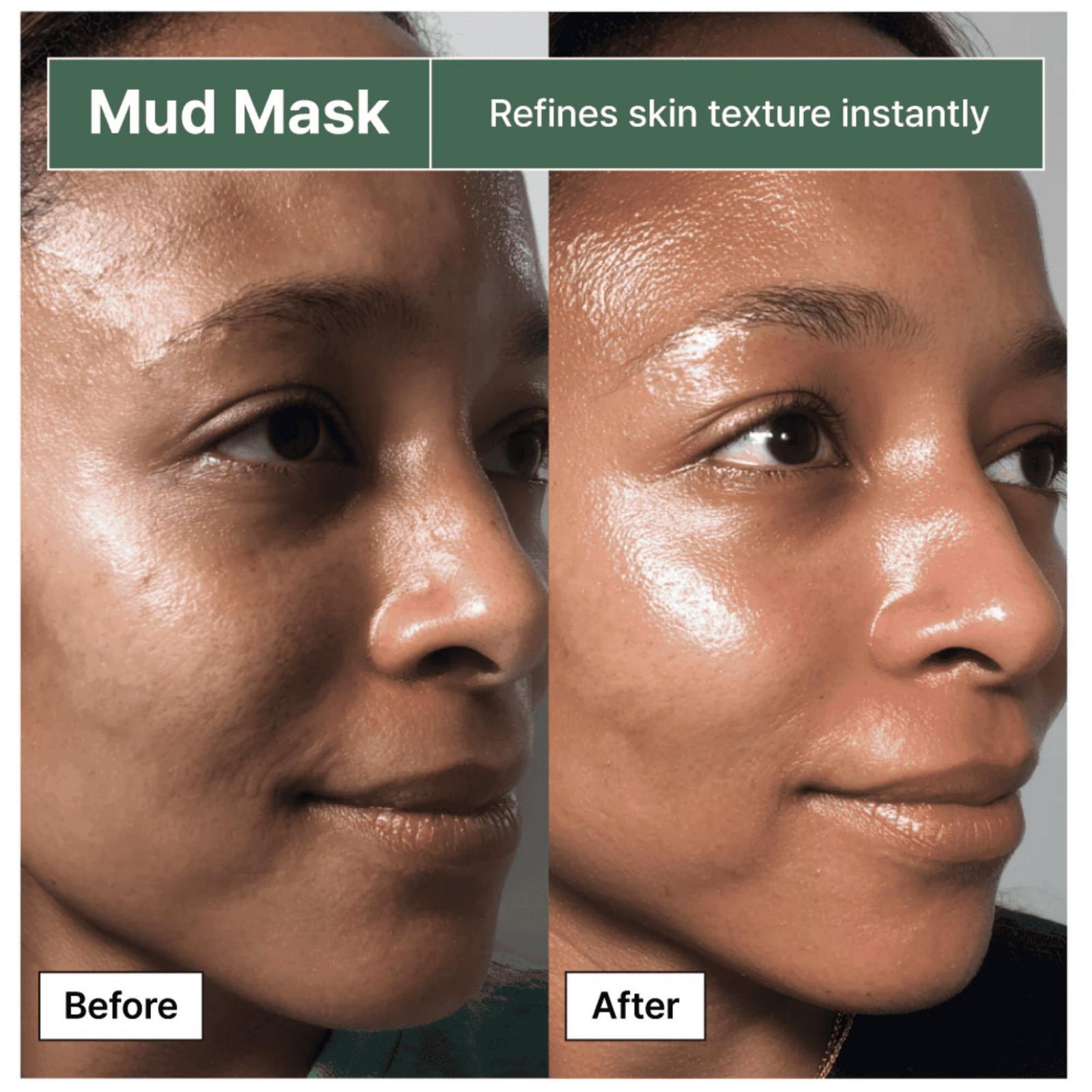 Relief Mud Mask