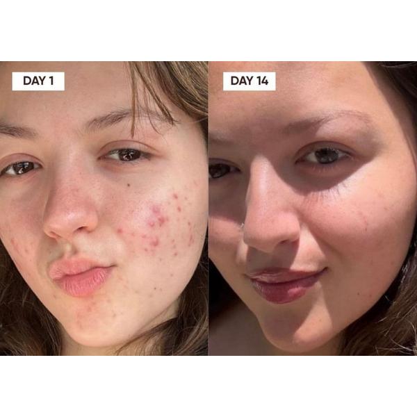 Plantkos Hydrating Moisturizer #3