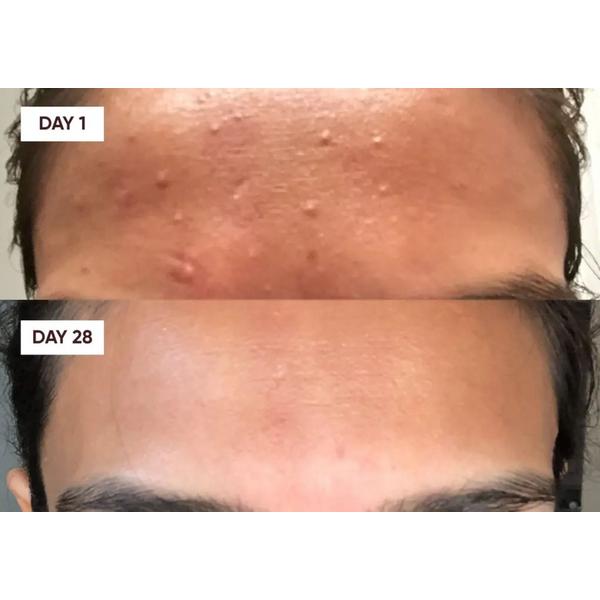 Plantkos Gentle Exfoliating Gel Cleanser #3