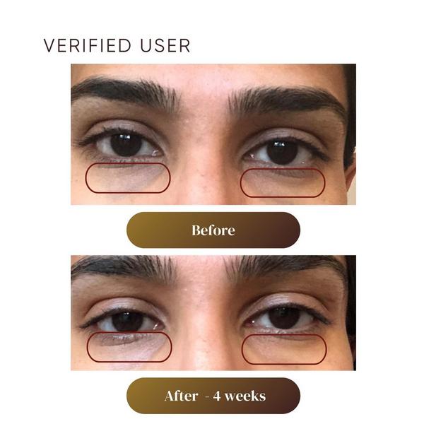 Plantkos Revitalizing Eye Cream #3