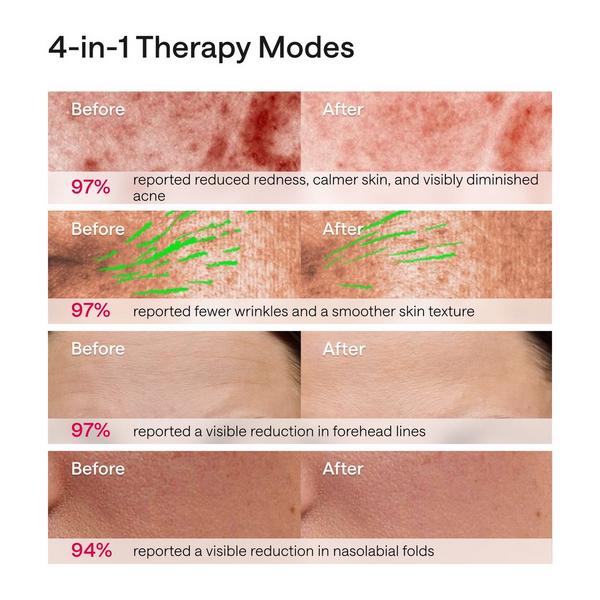 Ulike ReGlow 4-in-1 LED Light Therapy Mask #8