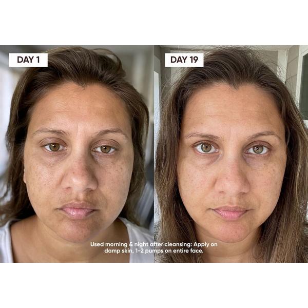 Plantkos Triple C Serum #4