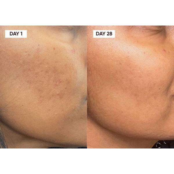 Plantkos Triple C Serum #5