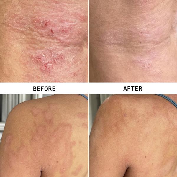 Hypothesis Precision Healing Spray #2