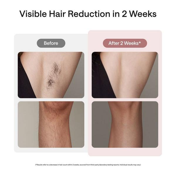 Ulike Air10 Ice Cooling IPL Hair Removal Device #4