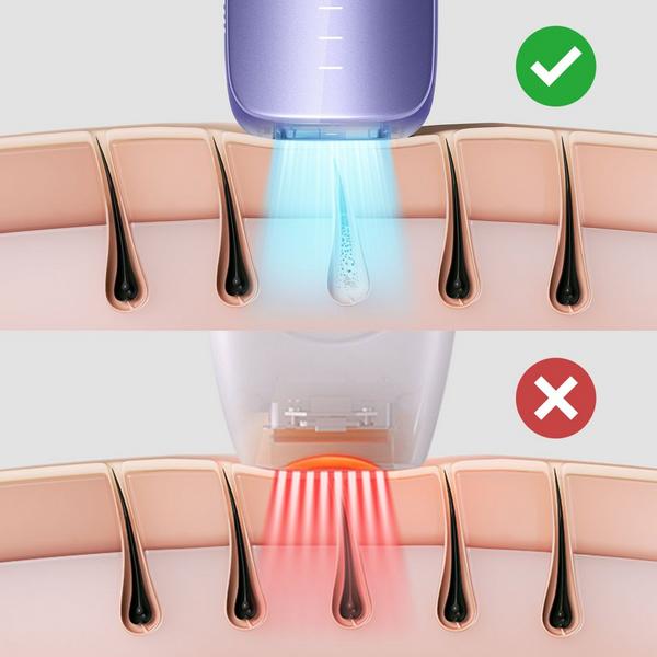 Ulike Air3 IPL Hair Removal Device #3