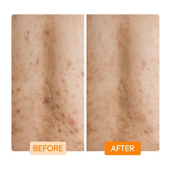 Makari Glycolic + Lactic Acid + Niacinamide Body Wash #5