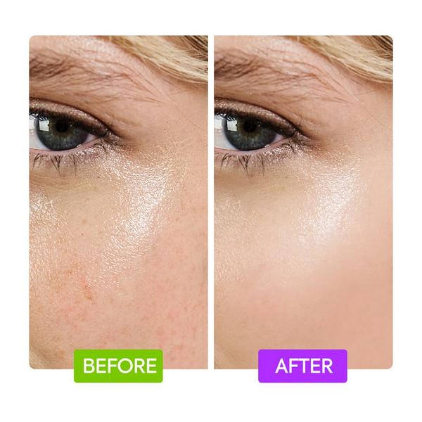 Makari 20% Aha + 10% Niacinamide Booster #3