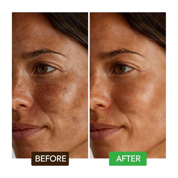 Makari Kojic Acid Dark Spot Remover Soap Bars #6