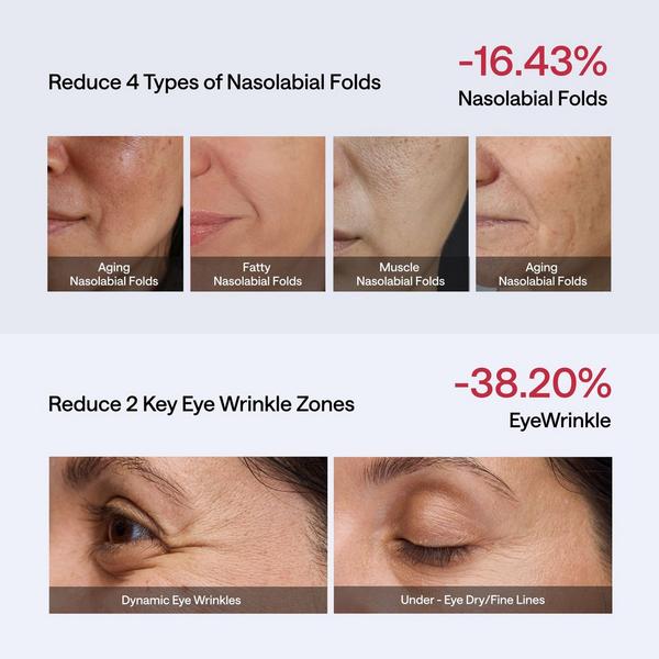Ulike JMOON NouvelleSkin Facial Toning Device #7