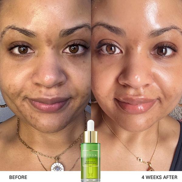 BYROE Celery AHA+LHA Resurfacing Serum #4
