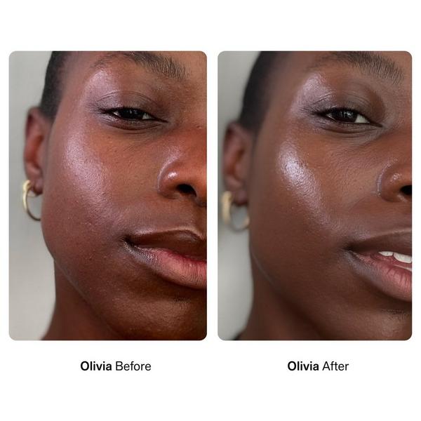 Nimbi Skin Renewal Facial Dermaplaners #7