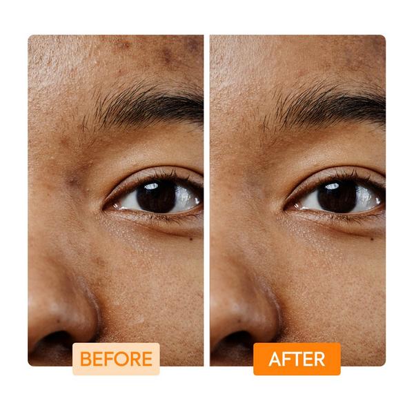 Makari Vitamin C & Turmeric Facial Cleaning Bar #3