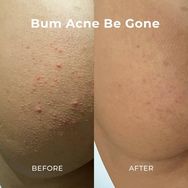 Miami Beach Bum Smoothing Oregano Body Duo #5