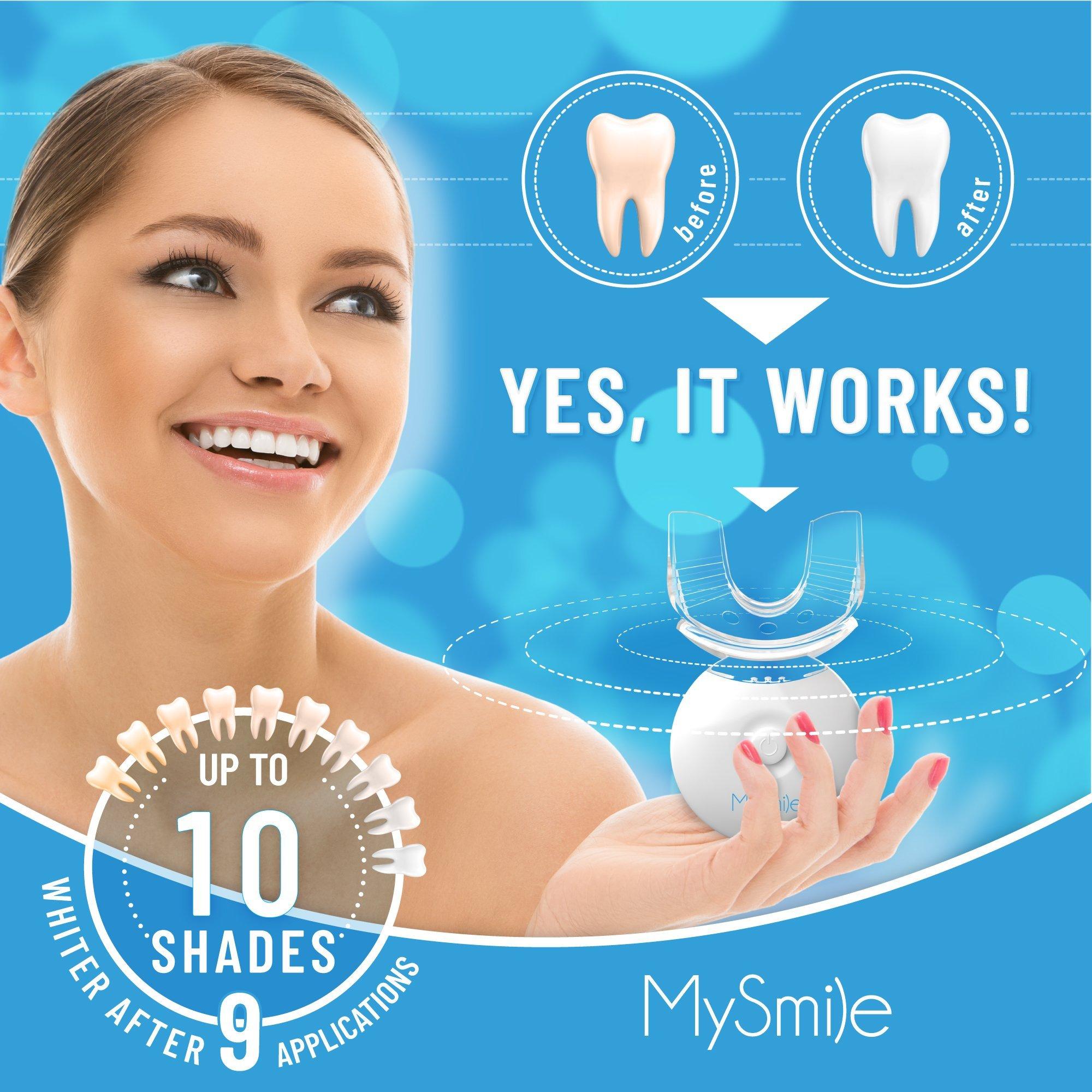 MySmile Teeth Whitening Kit - Thumbnail 5