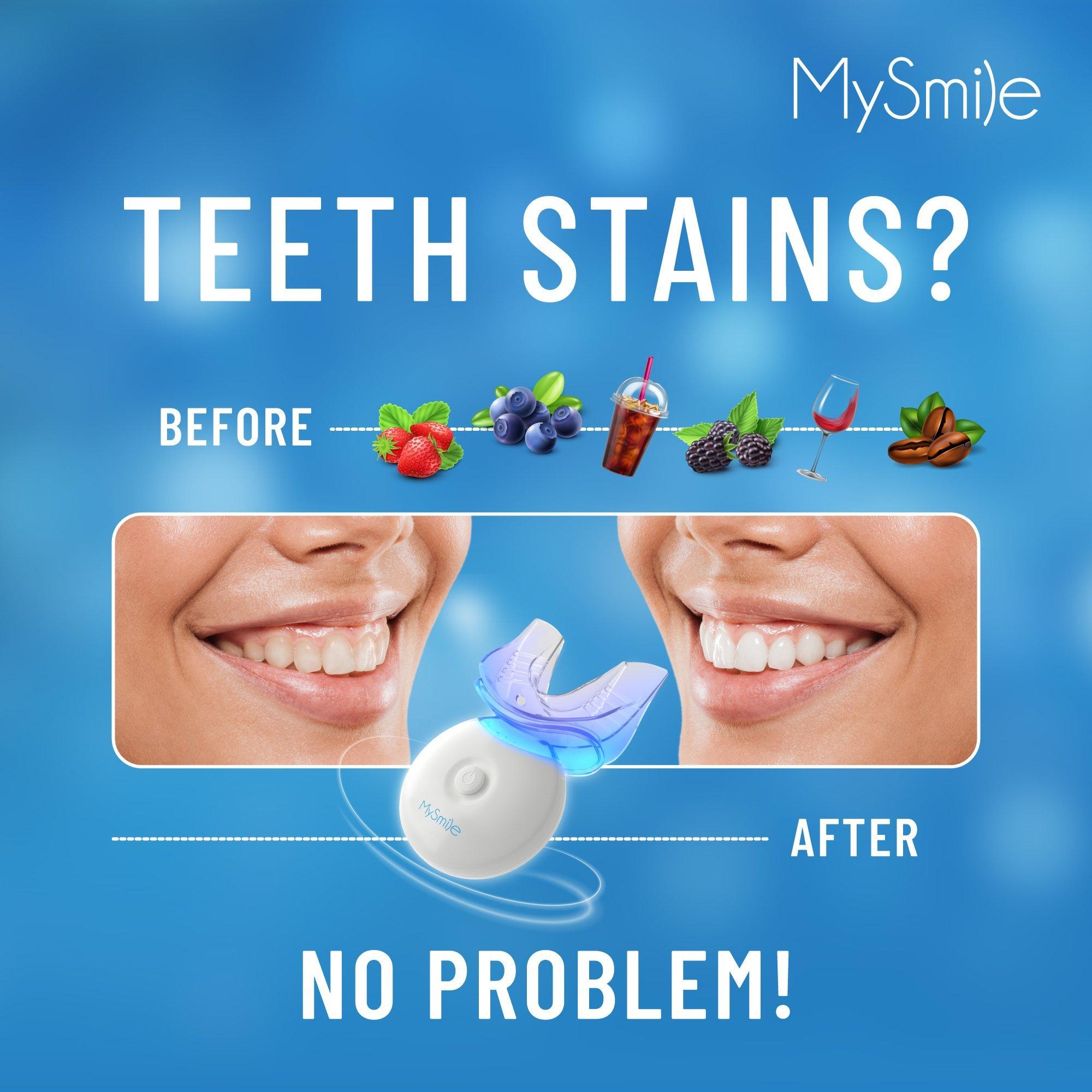 MySmile Teeth Whitening Kit - Thumbnail 4