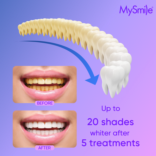 MySmile Teeth Whitening Gel Refill Pack #6